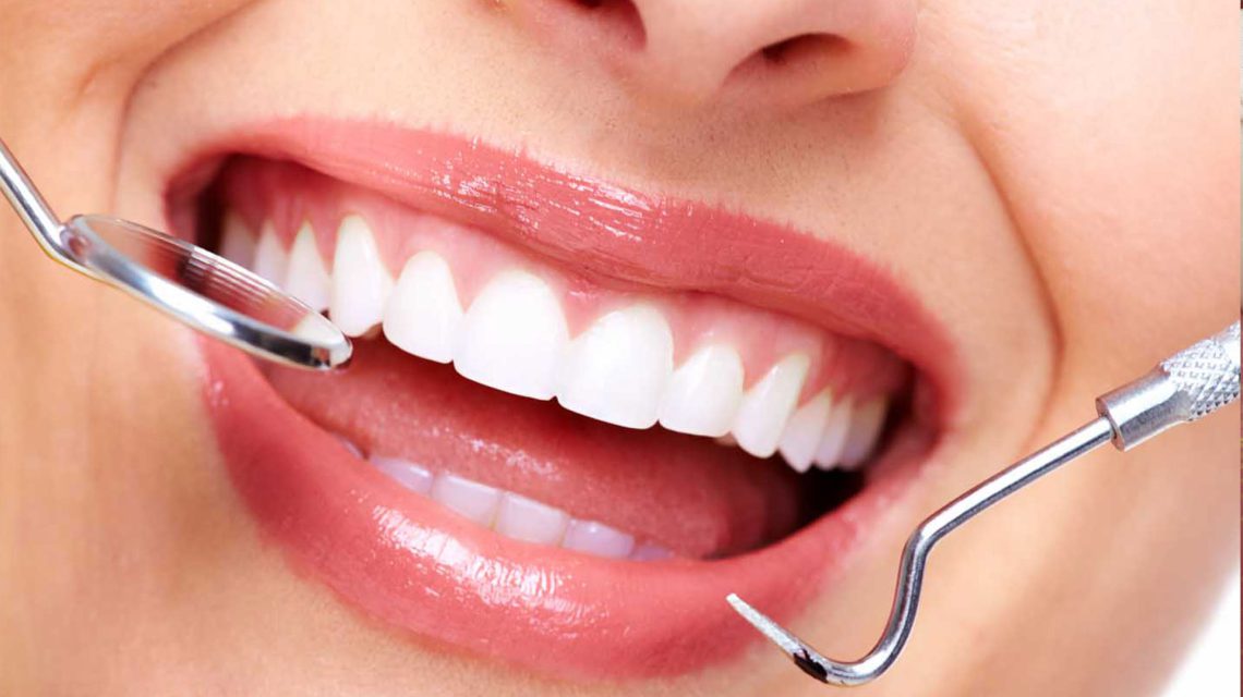 اصطلاحات دندانپزشکی