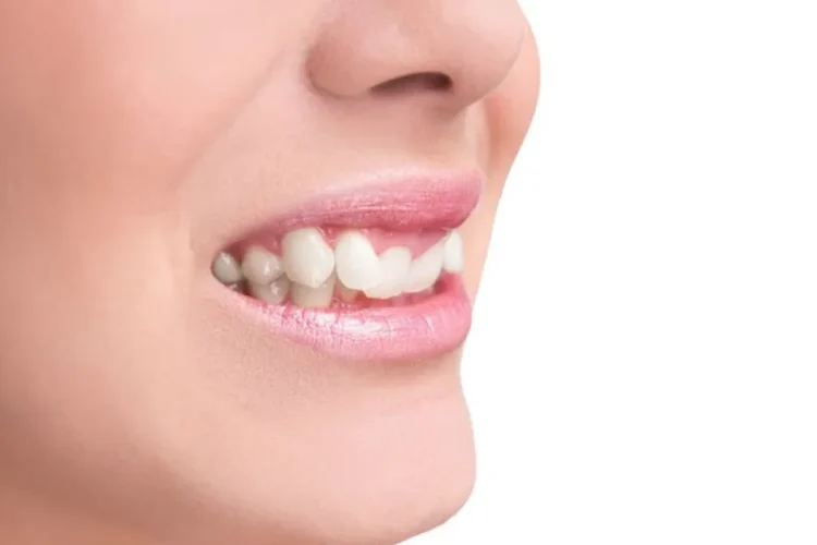 درمان ناهنجاری‌های دندانی