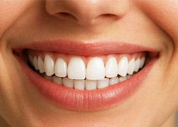 سفید کردن دندان