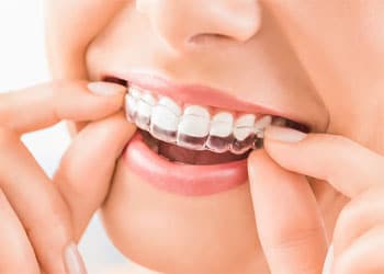 پرانتز نامرئی دندان