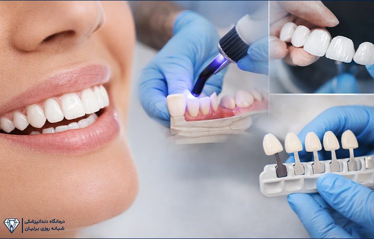 طراحی لبخند چیست