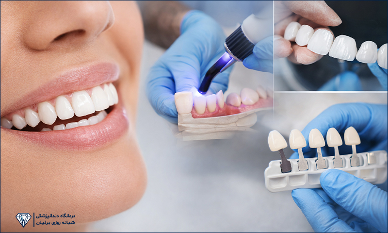 طراحی لبخند چیست