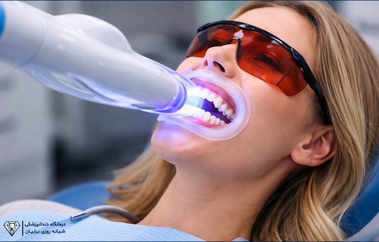 مزایا و معایب بلیچینگ دندان