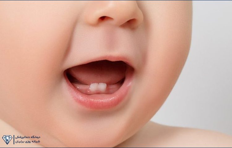 اولین دندان شیری و مسواک زدن نوزاد
