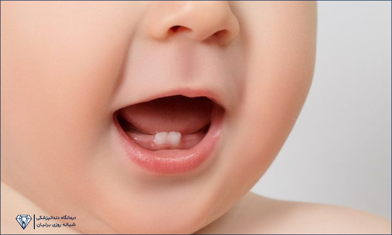 اولین دندان شیری و مسواک زدن نوزاد