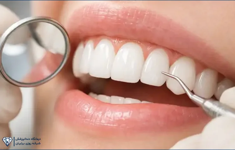 آیا می‌توان کامپوزیت قدیمی را ترمیم کرد؟
