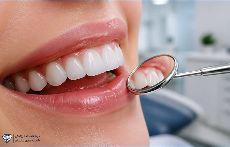 آیا کامپوزیت برای دندان‌های نامرتب مناسب است؟