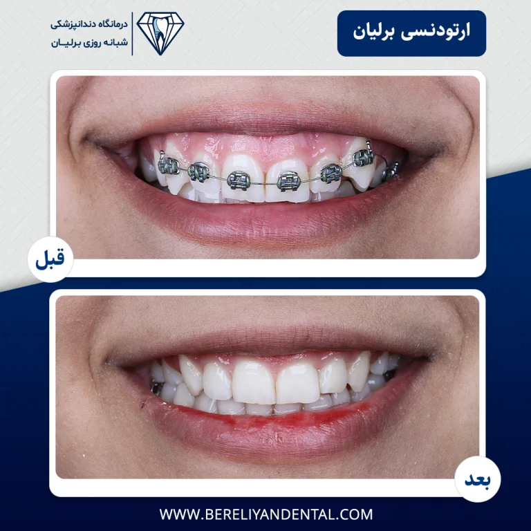 ارتودنسی 1405012