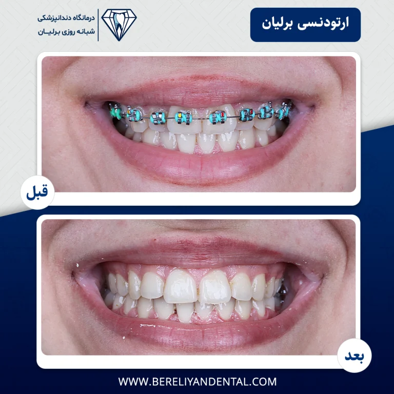 ارتودنسی 1405012110