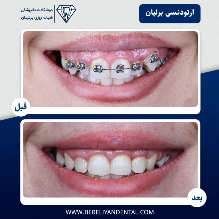 ارتودنسی 1405012111
