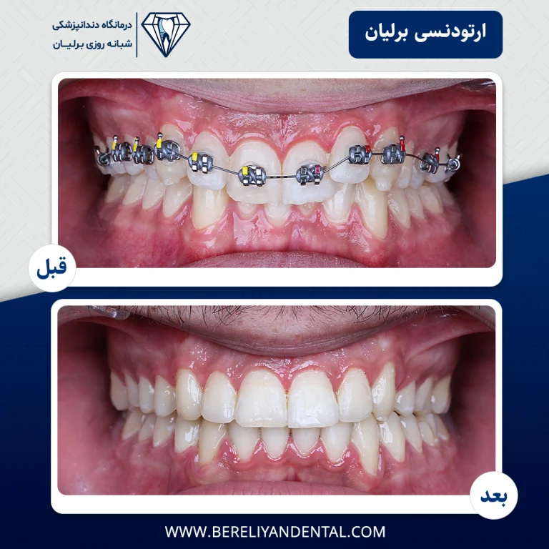 ارتودنسی 1405012112