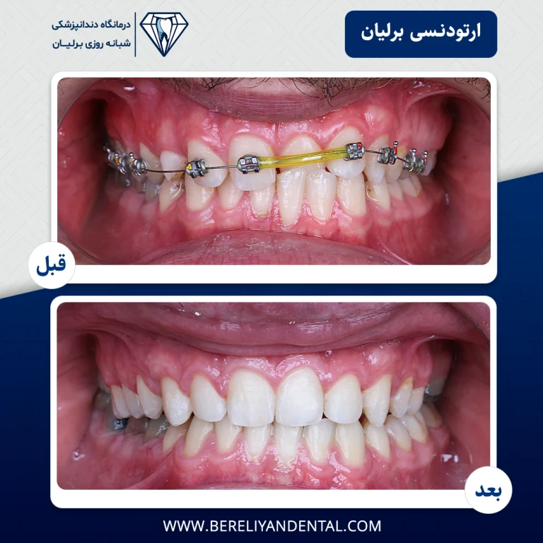 ارتودنسی 14050121120