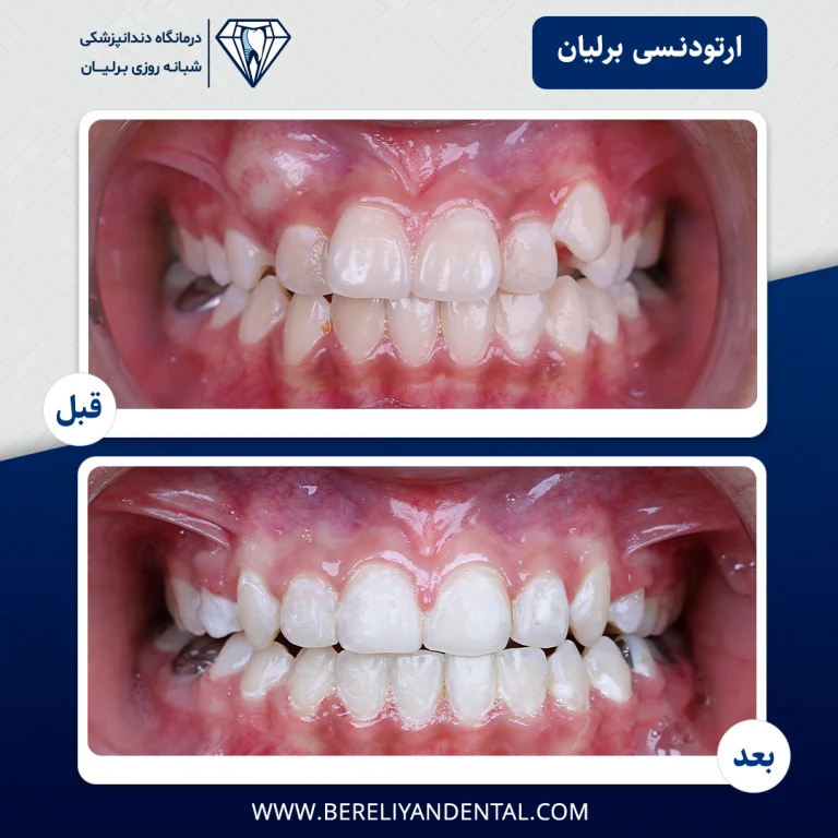 ارتودنسی 14050121121