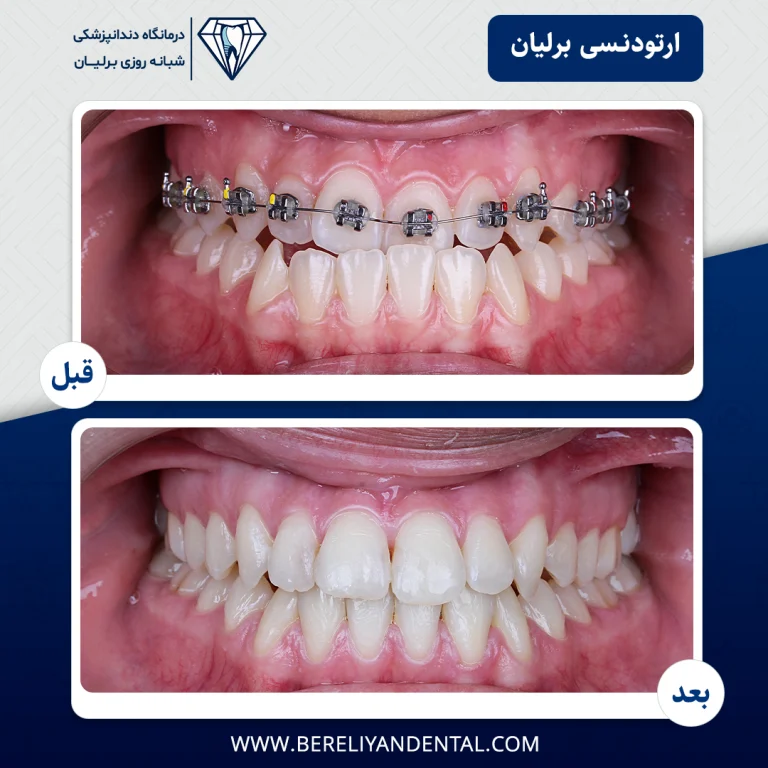 ارتودنسی 1405012113
