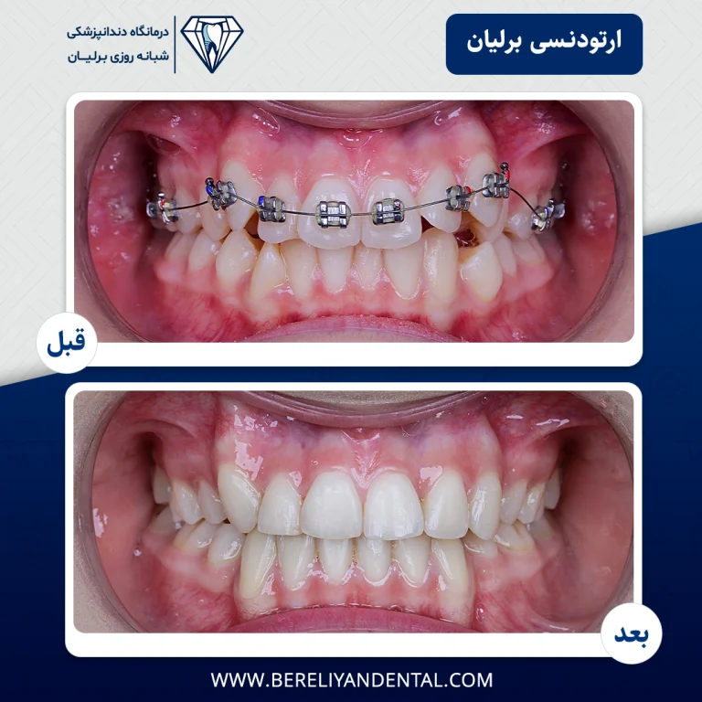 ارتودنسی 1405012114