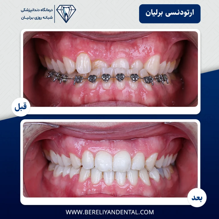ارتودنسی 1405012115