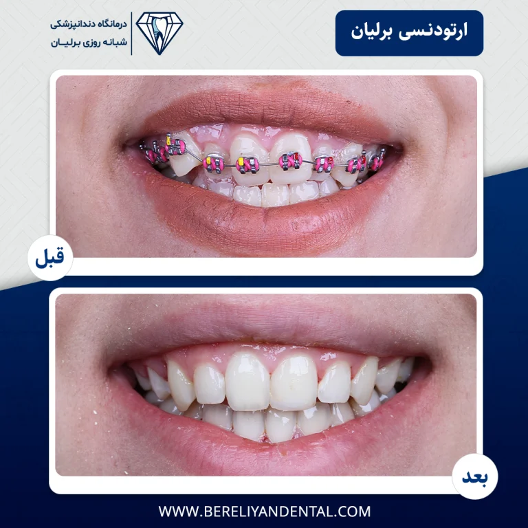 ارتودنسی 1405012116
