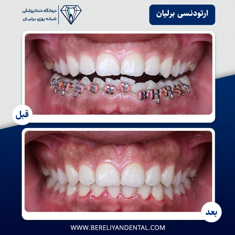 ارتودنسی 1405012117