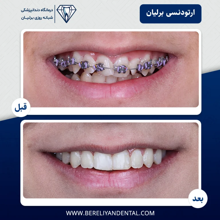ارتودنسی 1405012119