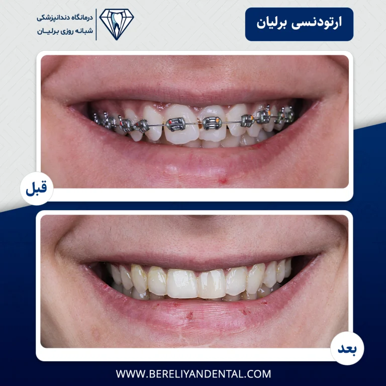 ارتودنسی 140501214