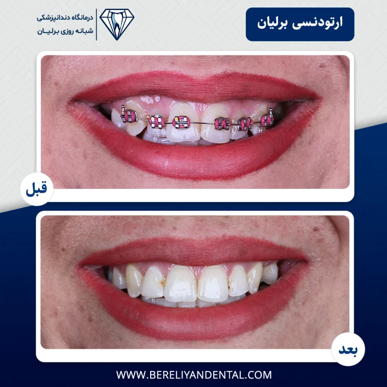 ارتودنسی 140501215