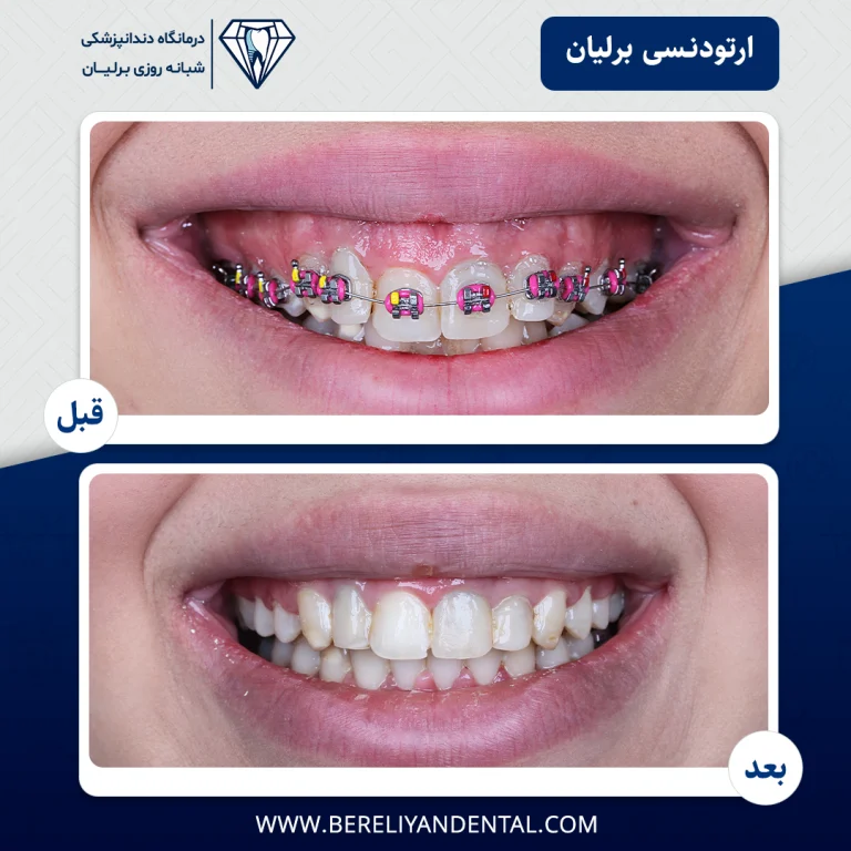 ارتودنسی 140501216