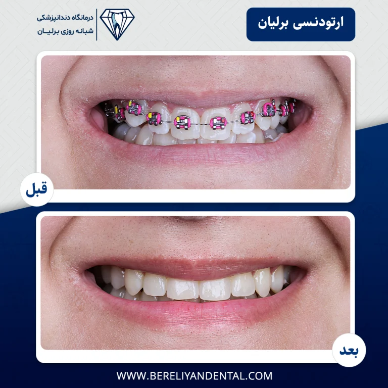 ارتودنسی 14050123