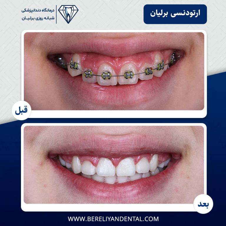ارتودنسی 14050124