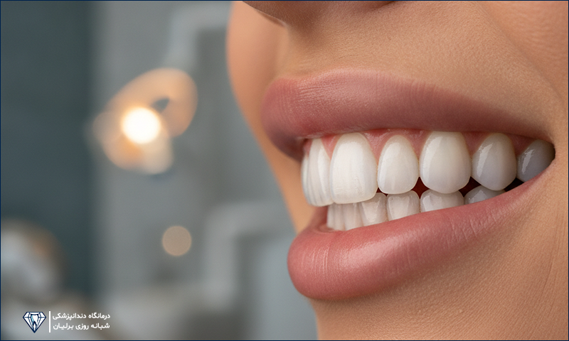 کامپوزیت لبه شیشه‌ای چیست؟