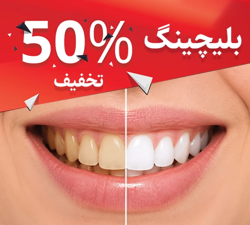 صفحه نخست 8 کمپین بلیچینگ جمعه 500x450 copy