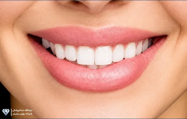 طراحی لبخند هالیوودی چیست
